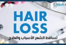 تساقط الشعر 001